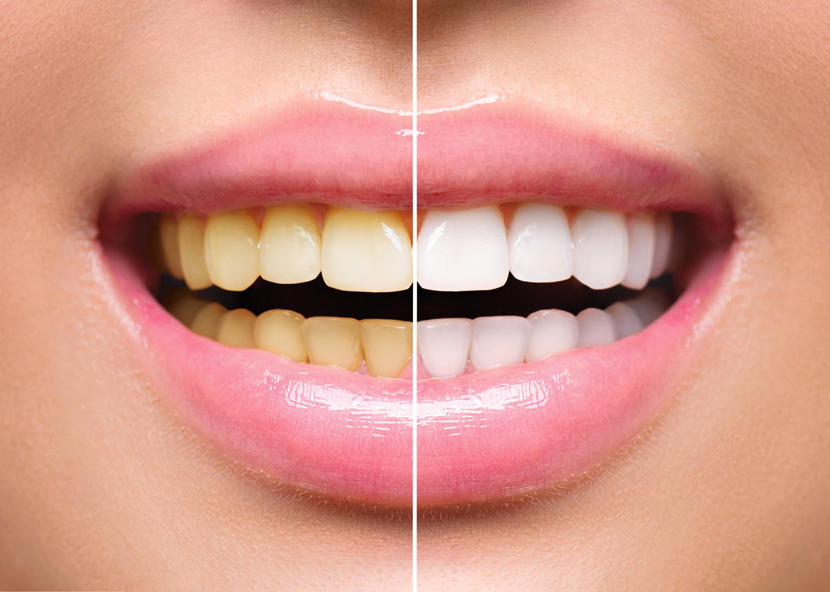 Southern Oak Dental Conway